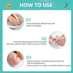 Nail Nurture Bee Venom 60 ml Pack of 2